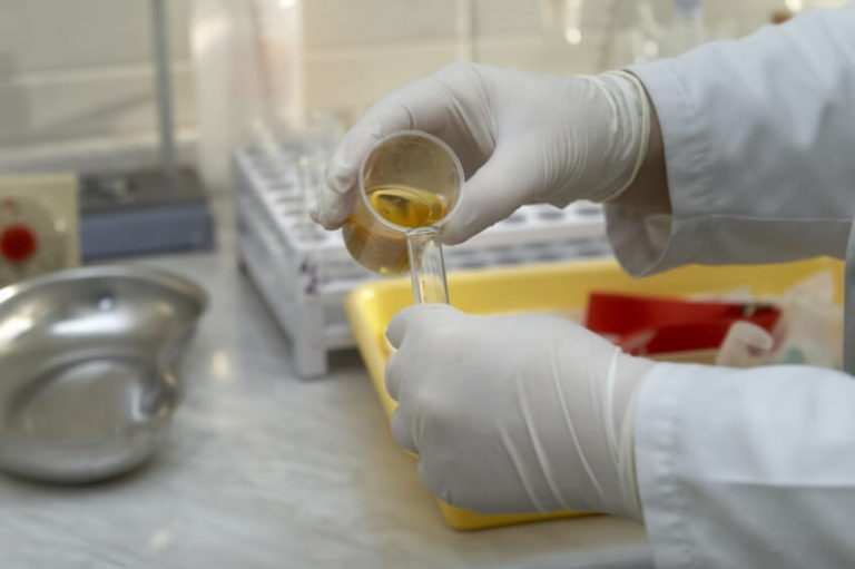 Which Drug Test do Life Insurance Companies Use